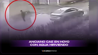 Hombre cae en agua hirviendo.