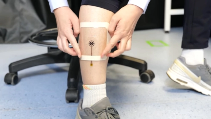 vendaje inteligente heridas app