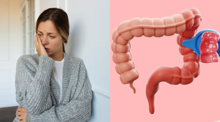 Estos síntomas comunes significan cáncer de colon y muy pocas personas les prestan atención