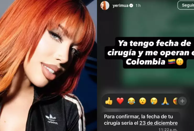 Yeri Mua se someterá a una riesgosa cirugía plástica esto se sabe.png