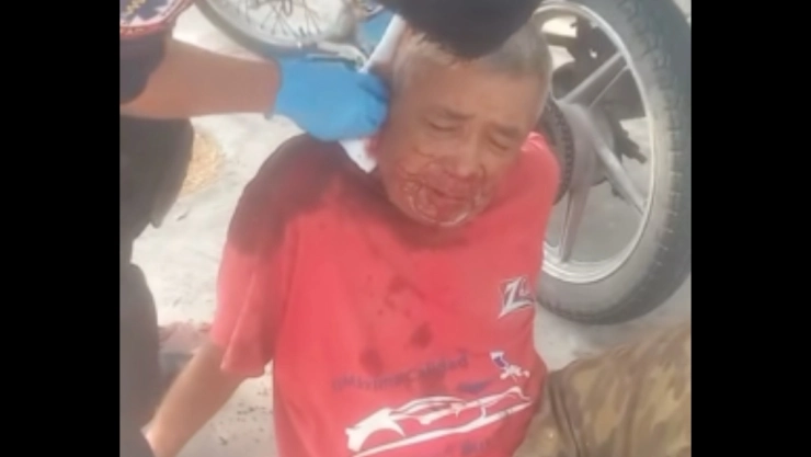 Abuelito atropellado en la colonia Miraflores