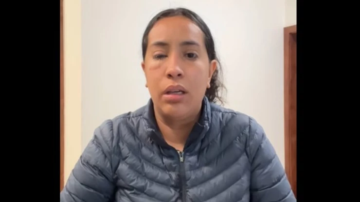 Mujer le lanza ácido en la cara en Tijuana, pide se haga justicia.