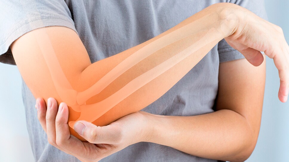 Osteoporosis en jovenes