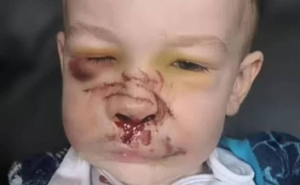 Bull terrier destroza cara de bebé de la familia