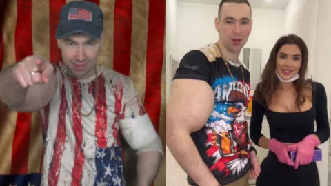 /al-extremo/popeye-ruso-inyecto-vaselina-brazos-podria-morir-pb-notas