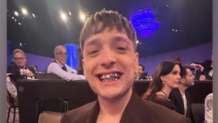 qué le pasó a peso pluma en los dientes