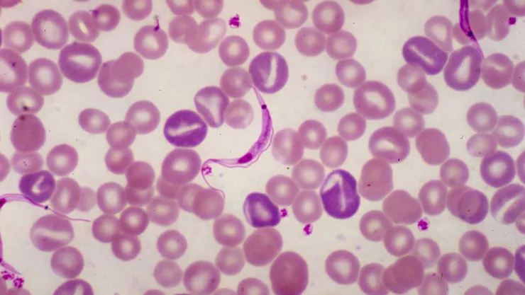 Trypanosoma Lewisi