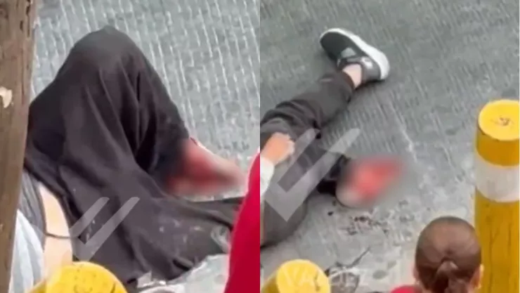 Peatón resulta con pie destrozado en Monterrey