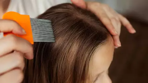 Cómo saber si mi hijo tiene piojos_ Cura y protección contra las liendres (1).jpg