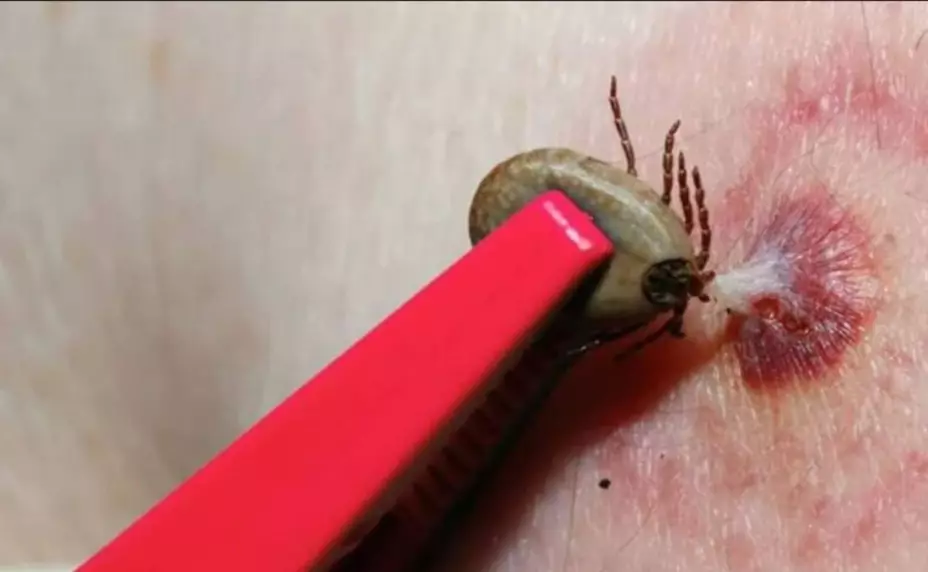 aumentan casos de alergia a la carne roja por culpa garrapata