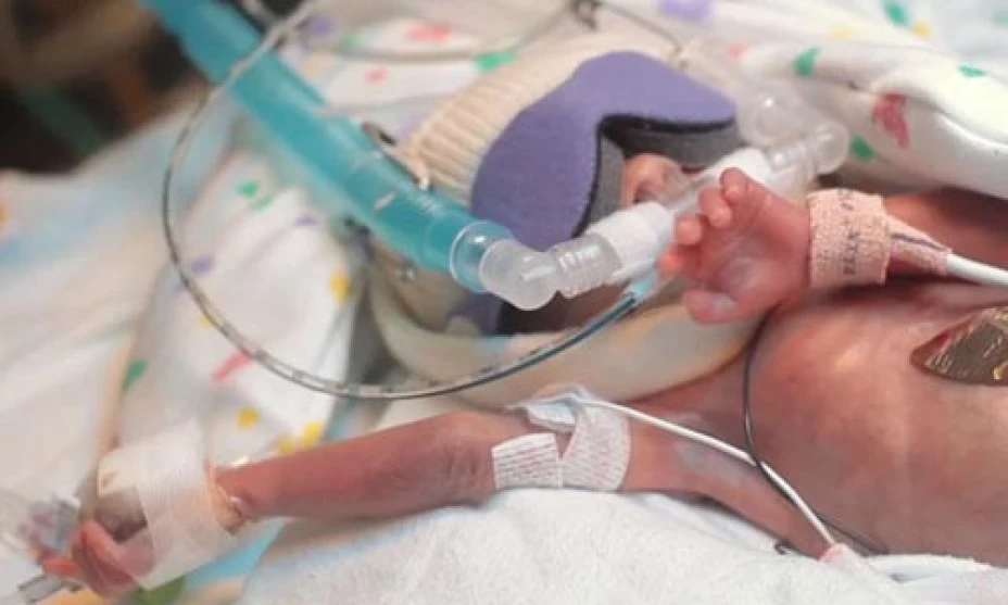 mamá, bebé prematuro