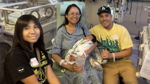 Caso médico en California: bebé se desarrolló fuera del útero sin ser detectado