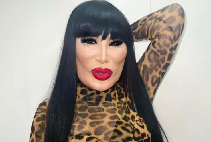 Lyn May pensó quitarse la vida tras arruinar su cara al inyectarse aceite.