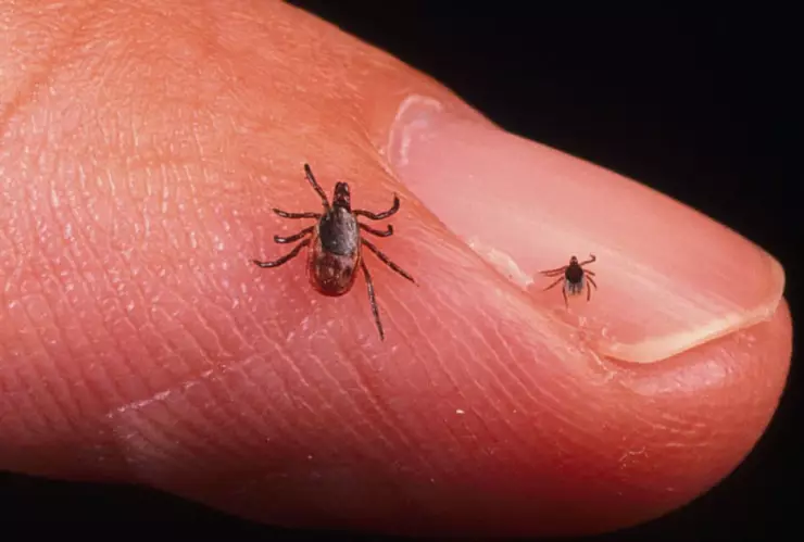 picadura de garrapata deja calva a mujer