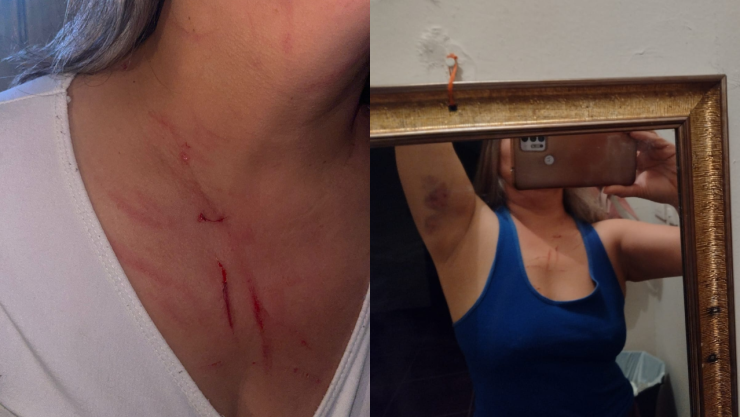 Mujer es agredida al sur de la capital