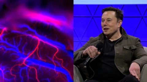Elon Musk asegura que primer paciente implantado con chip de Neuralink puede mover un ratón de computadora con la mente