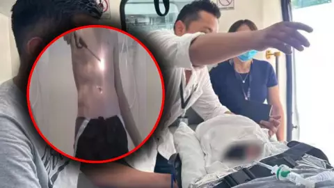 ¡Alerta por RETO VIRAL en Mérida! Niño de 7 años sufre quemaduras graves por el ‘Fire Challenge’: ¿De qué se trata?