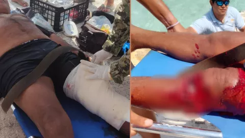 Ataque de tiburón en Banco Chinchorro deja a pescador herido