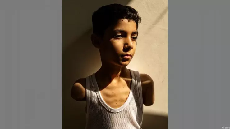 Retrato de un niño amputado de Gaza gana Foto del Año en World Press Photo 2025