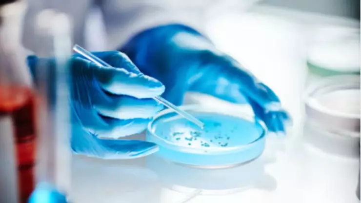 Epidemia de VIH repunta en México en las últimas semanas; ¿cuántos casos hay en Jalisco?