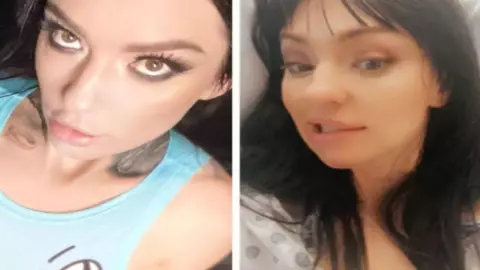 Mujer sufre de derrame cerebral