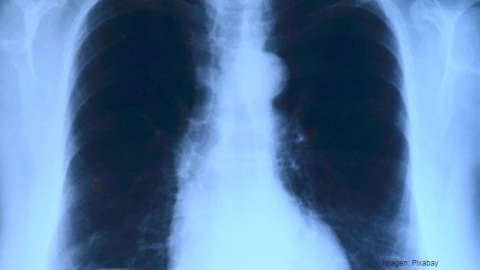 pulmones .jpg