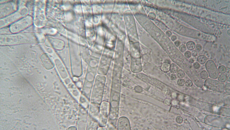 Bacteria que se presenta en el gym y como afecta