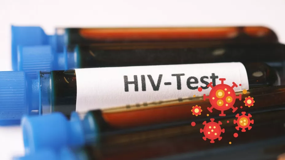 Las cifras oficiales de VIH en Zacatecas; aumentan casos en el estado