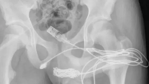 Se mete cable USB por el pene.jpg