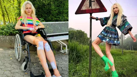 ¡Sorprendente! Modelo gasta más de 2 millones de pesos para intentar ser más alta