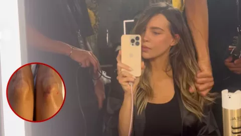 Belinda sorprende al compartir impactante FOTO de sus heridas por caída.jpg