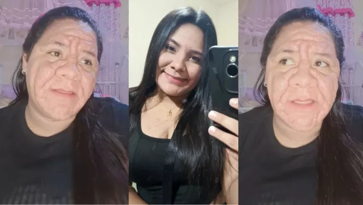 “Mi cara cambió drásticamente durante el embarazo”: joven se vuelve viral en TikTok