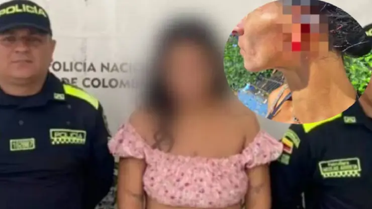 Mujer arranca oreja a su vecina por presunta infidelidad