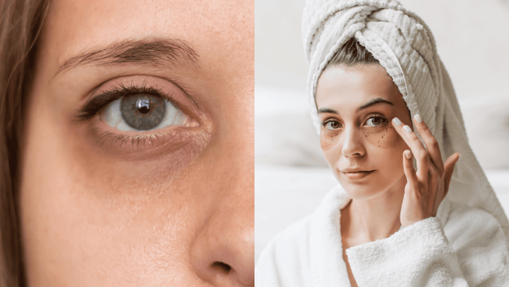 Estos son los contornos que debes usar al tener una mirada cansada.png