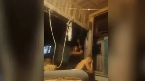 joven ruso se rompe el brazo para no ir a la guerra.jpg