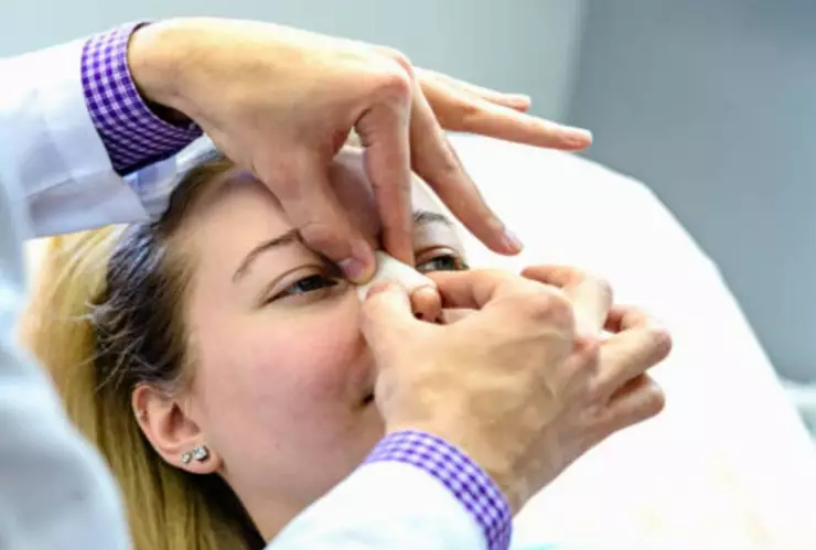 Se hizo una rinoplastia sin pensar que moriría al llegar a su casa