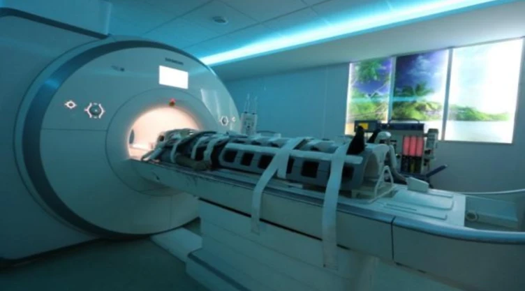 ¡Cuida tu salud! Lo que debes conocer sobre el infarto cerebral