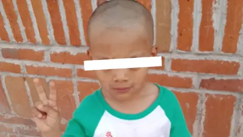 Niño se queda calvo por peinado loco