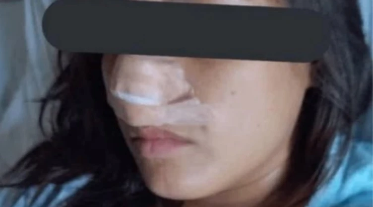 Jazmin nariz agresor prófugo