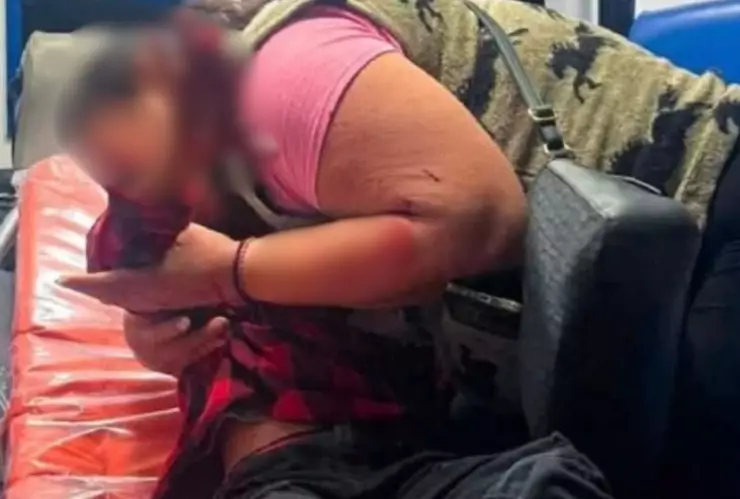 Cuete explotó en mano de niño y perdió los dedos en fiestas de Año Nuevo