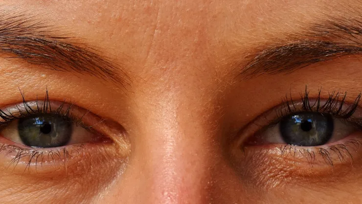 ¿Cómo eliminar las arrugas de los ojos? Mascarilla para piel radiante