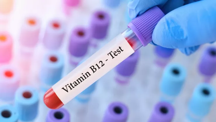 ¿Cómo saber que tienes deficiencia de vitamina B12? Estas son las causas