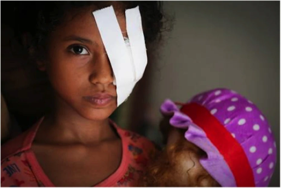 YEMEN NIÑOS