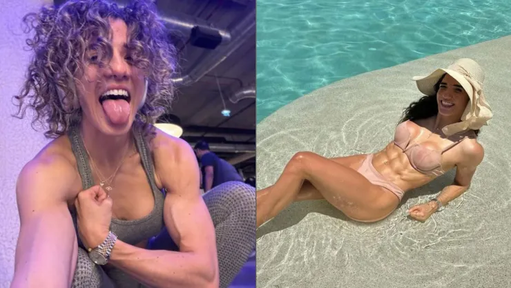Influencer mexicana, Jousfit sufre un infarto cerebral después de inyectarse botox en Dúbai