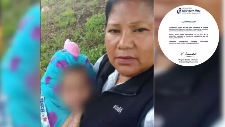 Jazlyn, nieta de la abuelita heroína de Iztapalapa, avanza en su recuperación en Texas, Estados Unidos