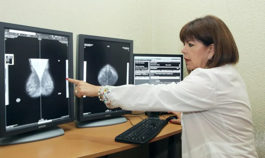 Cancer de Mama IMSS.jpeg