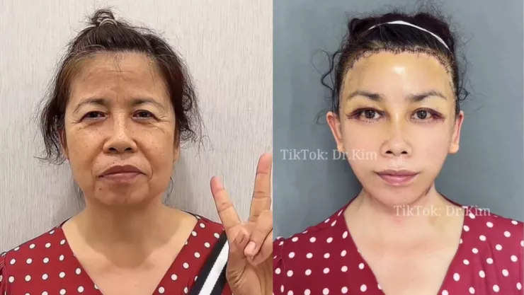 cirujano de tiktok dr kim.jpg