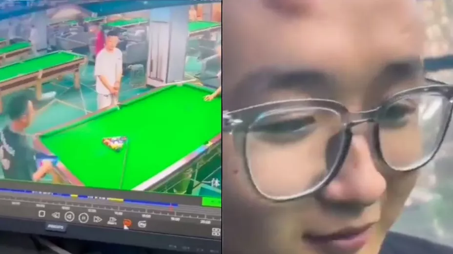 VIDEO: Joven es golpeado por una bola de billar y le queda enorme hinchazón