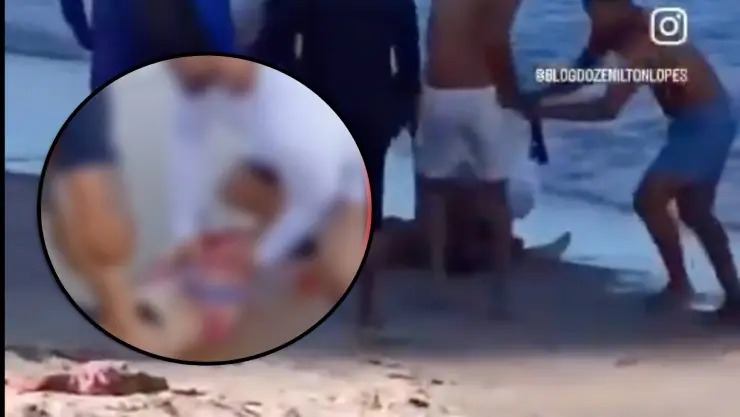Ataque de tiburón en Brasil deja una joven herida en la misma playa donde un niño perdió la pierna | VIDEO