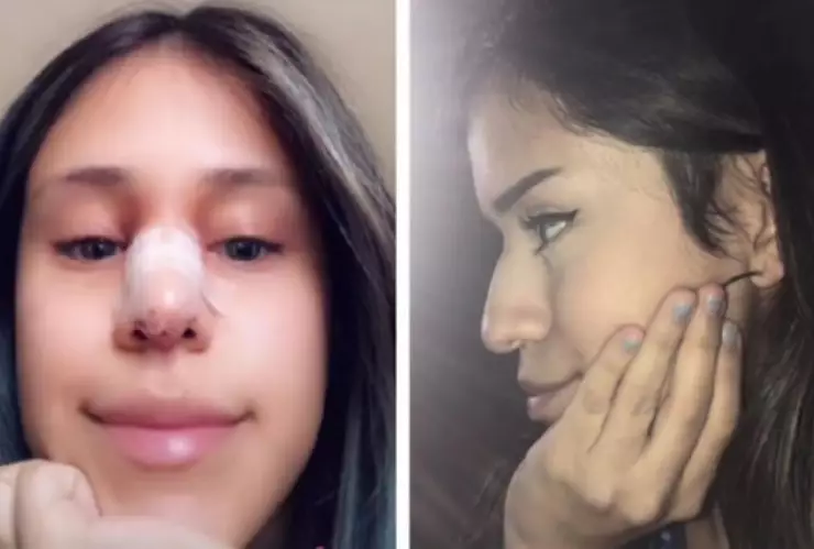 Perdona infidelidad a cambio de cirugía plástica